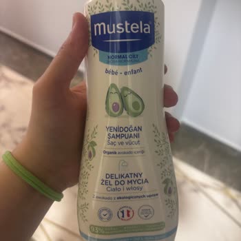 Mustela Şampuan Sonrası Kızımda Kızarıklık ve Konak Oluştu Çözüm Bekliyorum