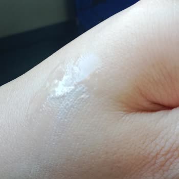 Aldığım Fondöten Cildimde Beklenmedik Sivilcelere Yol Açtı