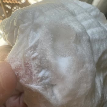 Molfix Bebek Bezinde Toz Kristaller Endişesi