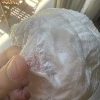 Molfix Bebek Bezinde Toz Kristaller Endişesi