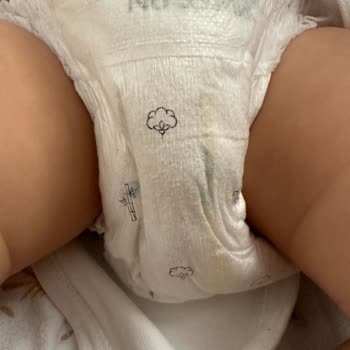 Sleepy Külot Bezde Sürekli Sızdırma Sorunu Ve Yetersiz Çözüm