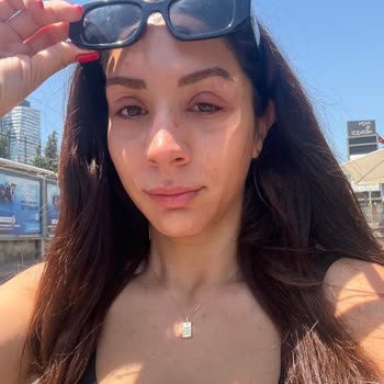 Hijyen Eksikliği Ve Dikkatsizlik Sonucu Göz Enfeksiyonu Yaşadım