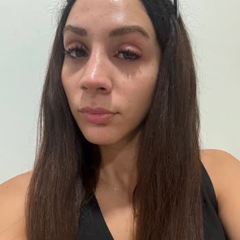 Hijyen Eksikliği Ve Dikkatsizlik Sonucu Göz Enfeksiyonu Yaşadım