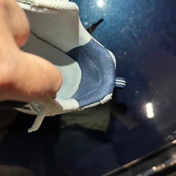 Az Kullanılan Ayakkabıda Hızlı Deformasyon Ve Red Cevabı Mağduriyeti