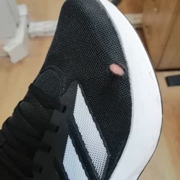 Bir Ayda Yırtılan Ayakkabıya Kullanıcı Hatası Denilmesi Mağduriyet Yarattı