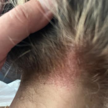 Kuaförde Yapılan Ombre İşlemi Sonrası Saçım Mahvoldu, Para İadesi Ve Fatura Verilmedi