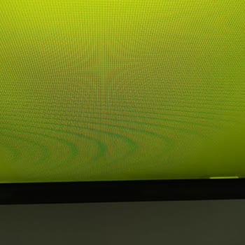 T**** Sonrası T* E******** Kalıcı S******* V* İlgisiz S*****