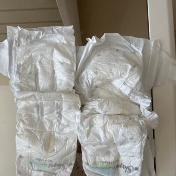 Aynı Markada Bez Kalitesi Neden Bu Kadar Değişti