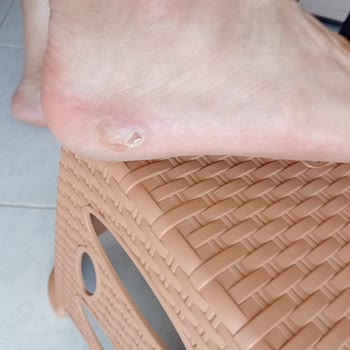 Satın Aldığım Ayakkabıda Kısa Sürede Oluşan Hasar Ve Değişim Talebimin Reddedilmesi