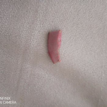 A101'den Aldığım Donuk Ispanaktan Plastik Çıkması