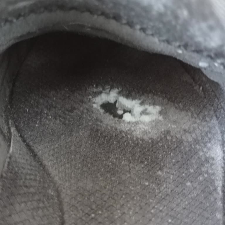 Bir Ayda Delinen Ayakkabıya Kullanıcı Hatası Yanıtı Şaşkınlığı