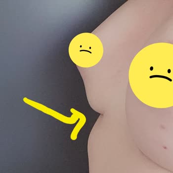 Op. Dr. Derya Bingöl Memnun Kalmama