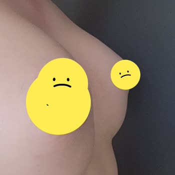 Op. Dr. Derya Bingöl Memnun Kalmama