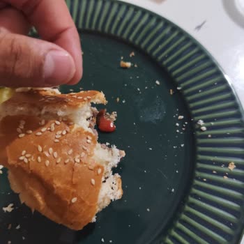 Siparişimde Saç Ve Bayatlık Şoku Hijyen Nerede