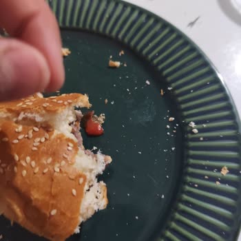 Siparişimde Saç Ve Bayatlık Şoku Hijyen Nerede