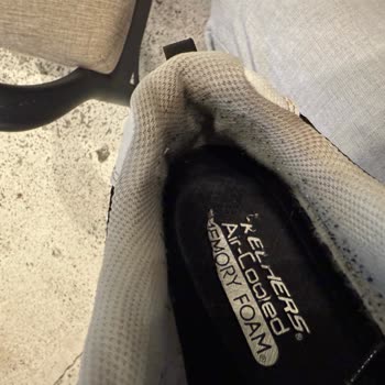 Ayakkabıda Koku Ve Tüylenme Sorunu, Müşteri Hizmetleri İlgisizliği