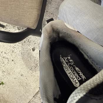 Ayakkabıda Koku Ve Tüylenme Sorunu, Müşteri Hizmetleri İlgisizliği