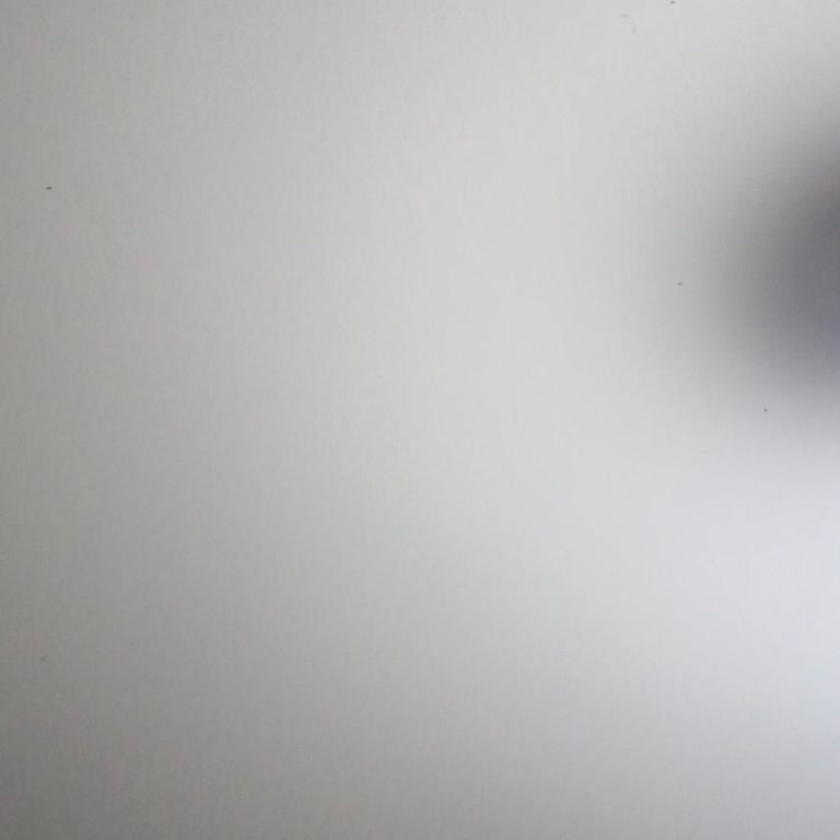 Çöp Konteyneri Yetersizliği Ve Kötü Koku Sorunu