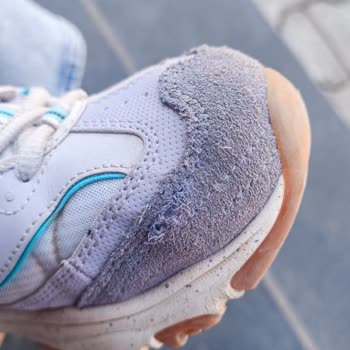 Kısa Sürede Deforme Olan Ayakkabı İçin Üretim Hatası İddiası Ve Destek Eksikliği