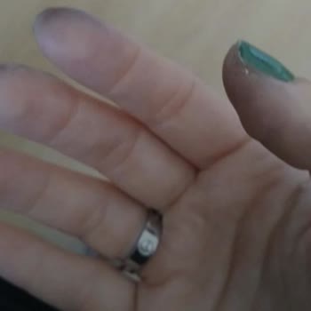 Sandalet Boyası Ayağıma Çıktı, İade Talebim Reddedildi