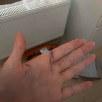 Sandalet Boyası Ayağıma Çıktı, İade Talebim Reddedildi