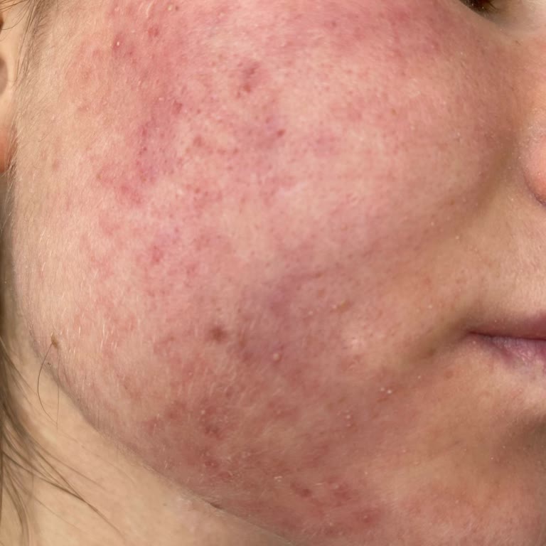 Neutrogena Yüz Yıkama Jeli Cildimde Şiddetli Reaksiyona Sebep Oldu