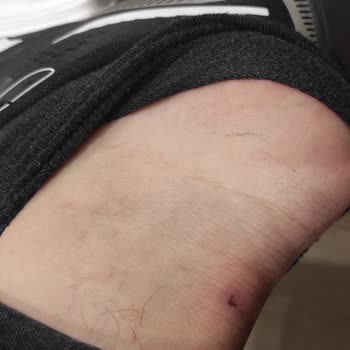 Aldığım Ayakkabı Ayağımı Yaraladı, Kusur Kabul Edilmedi