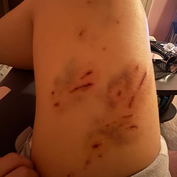 Acil Tedavi Sonrası 6 Ay Sonra Gelen Ücret Mesajı Şaşkınlığı