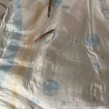 Bebek Bezi İçinden Tahta Parçası Çıkması Ve Güvenlik Endişesi