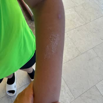 Teknosa Ve Kuba'dan Aldığım Bisikletin Kurulum Sürecinde Yaşadığım Sorunlar