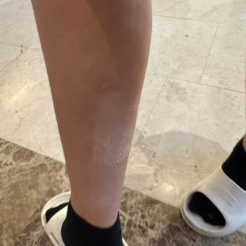 Teknosa Ve Kuba'dan Aldığım Bisikletin Kurulum Sürecinde Yaşadığım Sorunlar