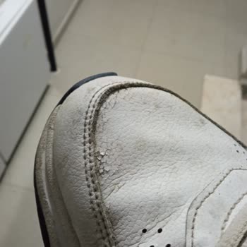 Adidas Ayakkabıda Erken Deformasyon Ve İade Sürecinde Destek Eksikliği