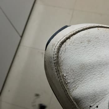 Adidas Ayakkabıda Kısa Sürede Çatlaklar Ve İade Sürecinde Trendyol İle Koray Spor Mağduriyeti