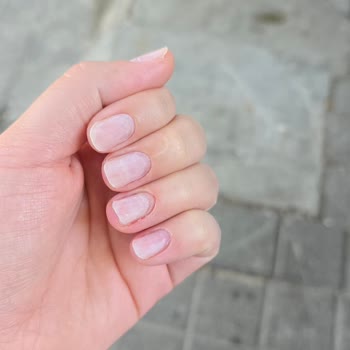 Eksik Ve Özensiz Hizmet, Haksız Komisyon!