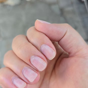 Eksik Ve Özensiz Hizmet, Haksız Komisyon!