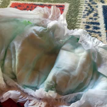 Canbebe Bebek Bezi Sürekli Sızdırıyor, Çözüm Bekliyorum