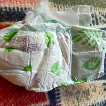 Canbebe Bebek Bezi Sürekli Sızdırıyor, Çözüm Bekliyorum