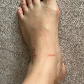 Guess Sandaletin Tasarımı Ayağımı Yaraladı, Firma Sorumluluk Almadı