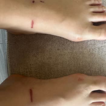 Guess Sandaletin Tasarımı Ayağımı Yaraladı, Firma Sorumluluk Almadı