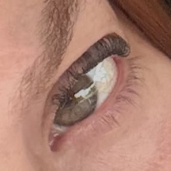 Medisam Güzellik Merkezi Kirpik Lifting Mağduriyeti