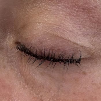 Medisam Güzellik Merkezi Kirpik Lifting Mağduriyeti