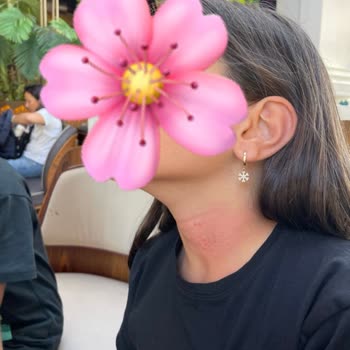 The Hunger Müdürün Tavrı