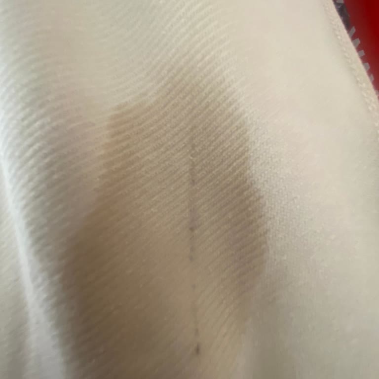 Aldığım Eşofman Defolu Geldi, Sürekli Aynı Sorunu Yaşıyorum