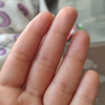 Yves Rocher Güneş Kremi Cildimde Soyuluyor Ve Parça Parça Çıkıyor