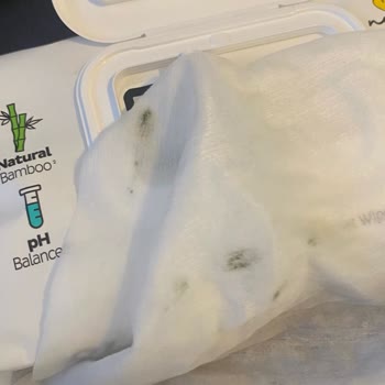 Küflü Islak Mendiller Çocuğumun Sağlığını Tehlikeye Attı