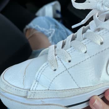 Kısa Sürede Deforme Olan Ayakkabı İçin İade Reddi Mağduriyeti