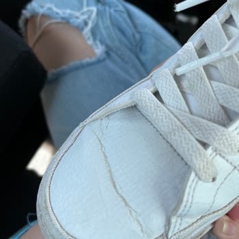 Kısa Sürede Deforme Olan Ayakkabı İçin İade Reddi Mağduriyeti