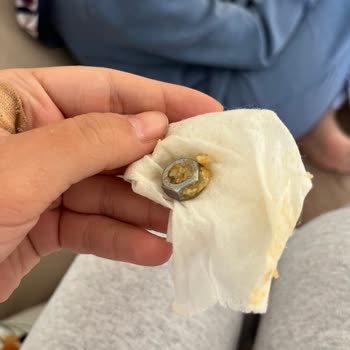 Şekerin İçinden Vida Çıkmasıyla Yaşadığımız Şok