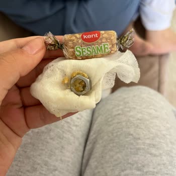 Şekerin İçinden Vida Çıkmasıyla Yaşadığımız Şok