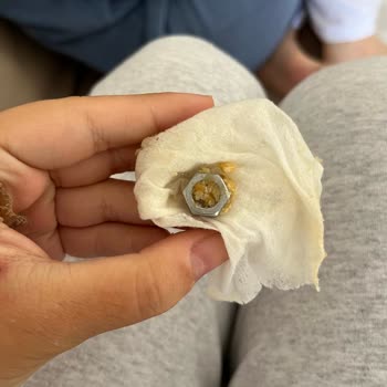 Şekerin İçinden Vida Çıkmasıyla Yaşadığımız Şok